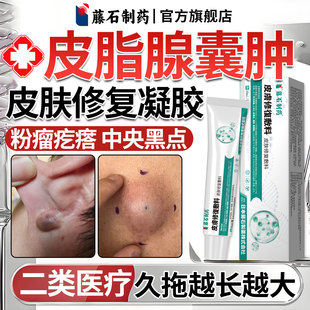 藤石制药皮脂腺囊肿粉瘤硬块火疖子疖肿脓包拔毒拔脓专用搭膏贴YZ