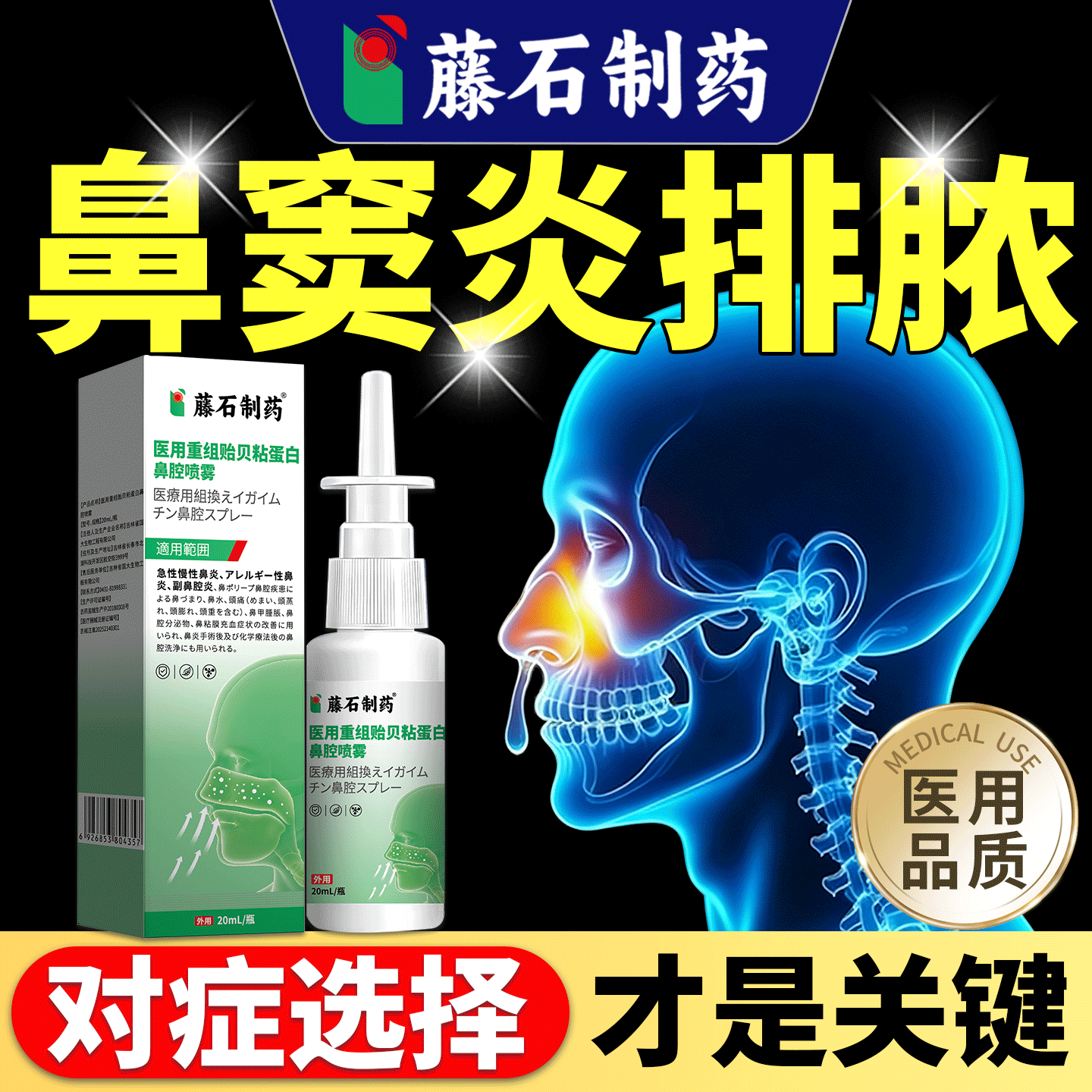 【鼻窦炎排脓】鼻塞头疼鼻涕倒流图片