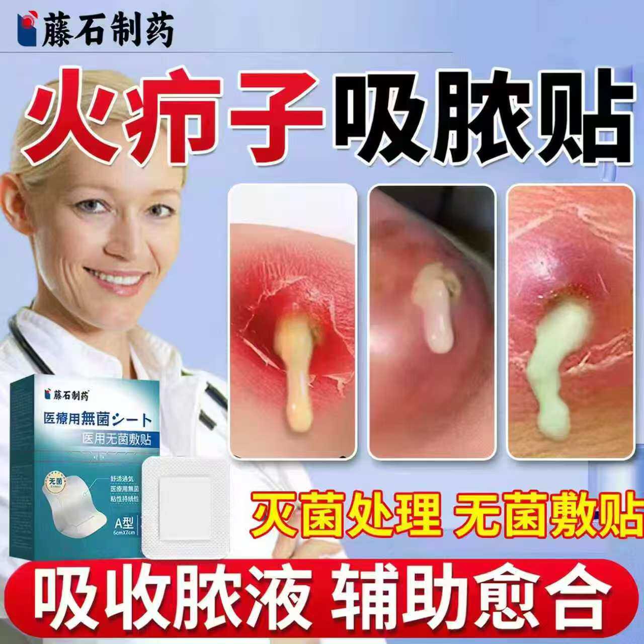 藤石制药火疖子疖肿伤口敷料贴毒脓膏脓包硬块吸脓贴神无菌器NP
