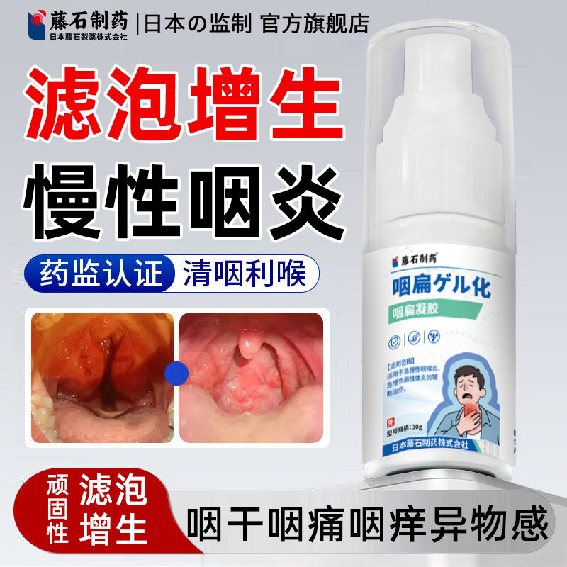藤石制药滤泡增生慢性咽炎咽喉咽后壁淋巴咽喉炎舌根异物感喷剂SY
