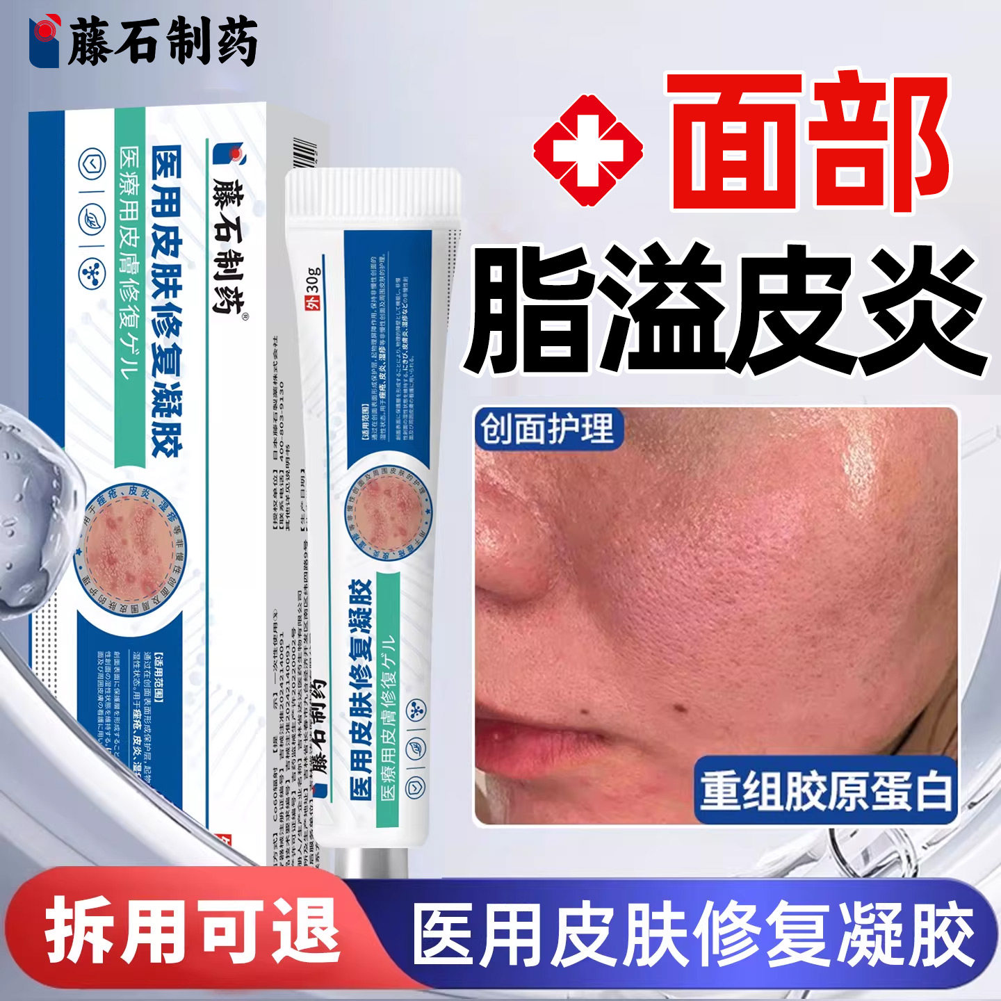 藤石制药面部脂溢性皮炎医用皮肤修复凝胶软膏痤疮湿疹马拉色菌SY