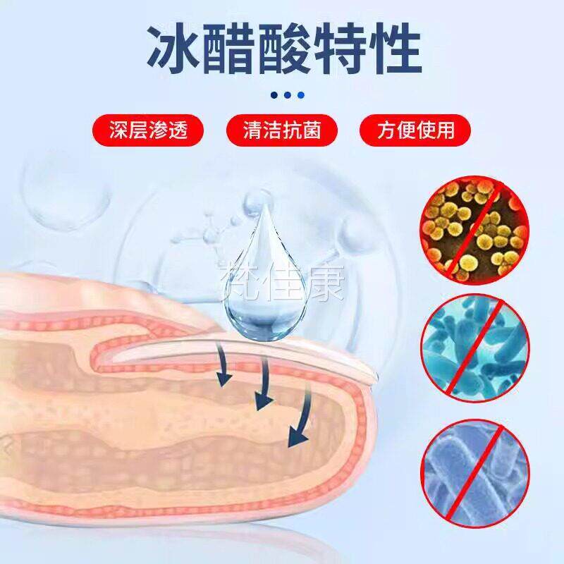 3浓0%冰醋酸菌液高抗度LUT乙酸稀释泡冰脚皮肤外涂用剂指甲抑菌溶