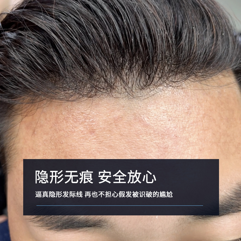 假发男式头顶补发递针全真发织发块秃顶前额发际线隐形短毛寸