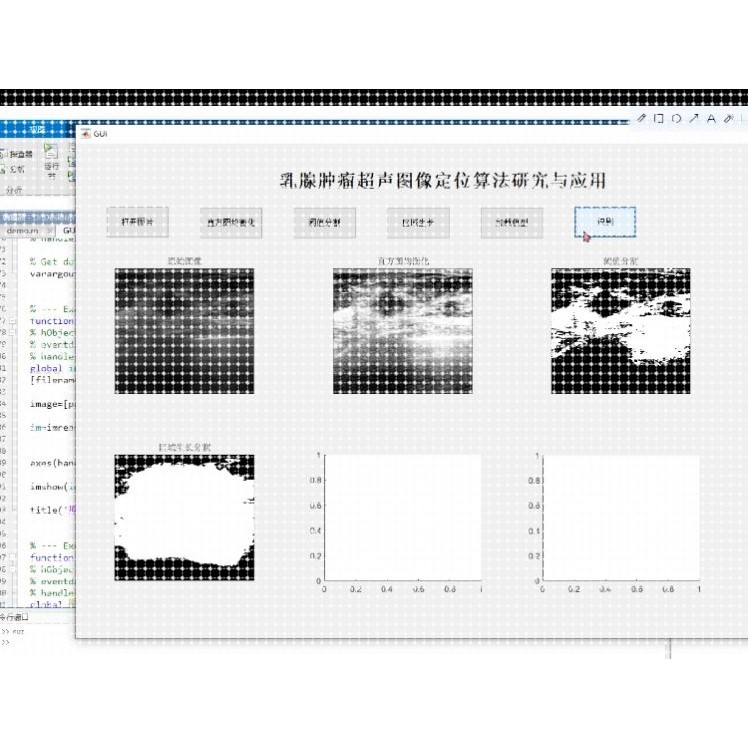 Python代编深度机器学习接单matlab代码编程数据分析预测图像处理