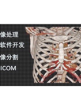 医学图像处理DICOM图像、图像分割、深度学习人工智能、软件开发