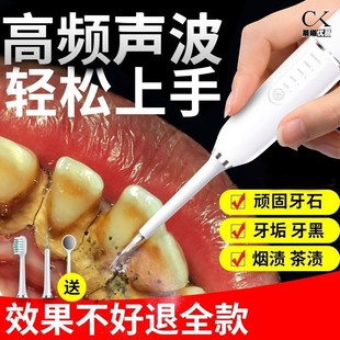 掏剔抠牙结石神器扣牙石清理刮牙垢器清除工具去除器头专业声波