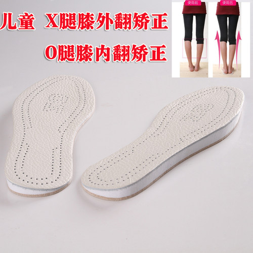 儿童足内翻膝内翻lX腿O型腿矫正鞋垫胫骨内旋内八字外八字矫正器