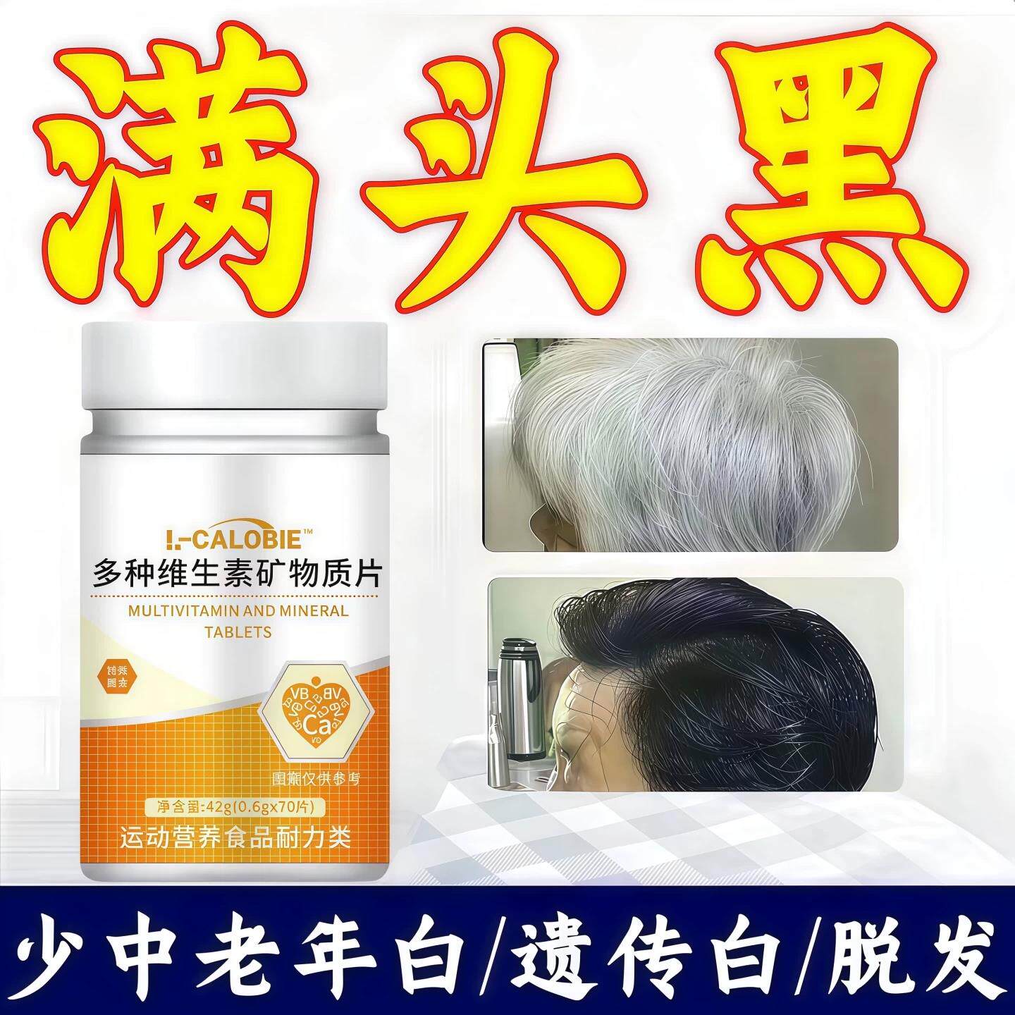 婴舒多维素堂乌发素高元