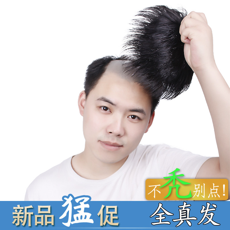 男士补发片假发套头顶补s发前额秃顶补发垫接发翻盖假发真发男发
