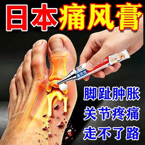 日本痛风止痛消结石关节肿胀鼓包