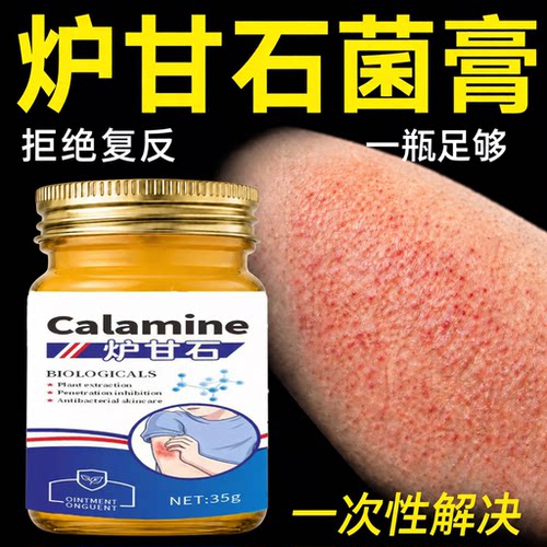 炉甘石软膏湿疹止痒去皮炎根藓痒