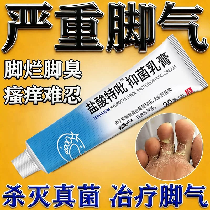 【脚痒气克星】盐酸特比萘乳芬膏