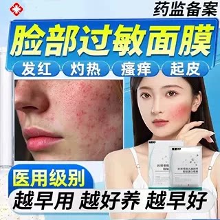抗过敏皮肤修复脸部泛红痒肌肤皮炎用医脱敏补水干燥起皮膜面膏AY
