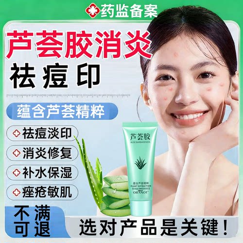芦荟胶保湿淡化痘印四季可用