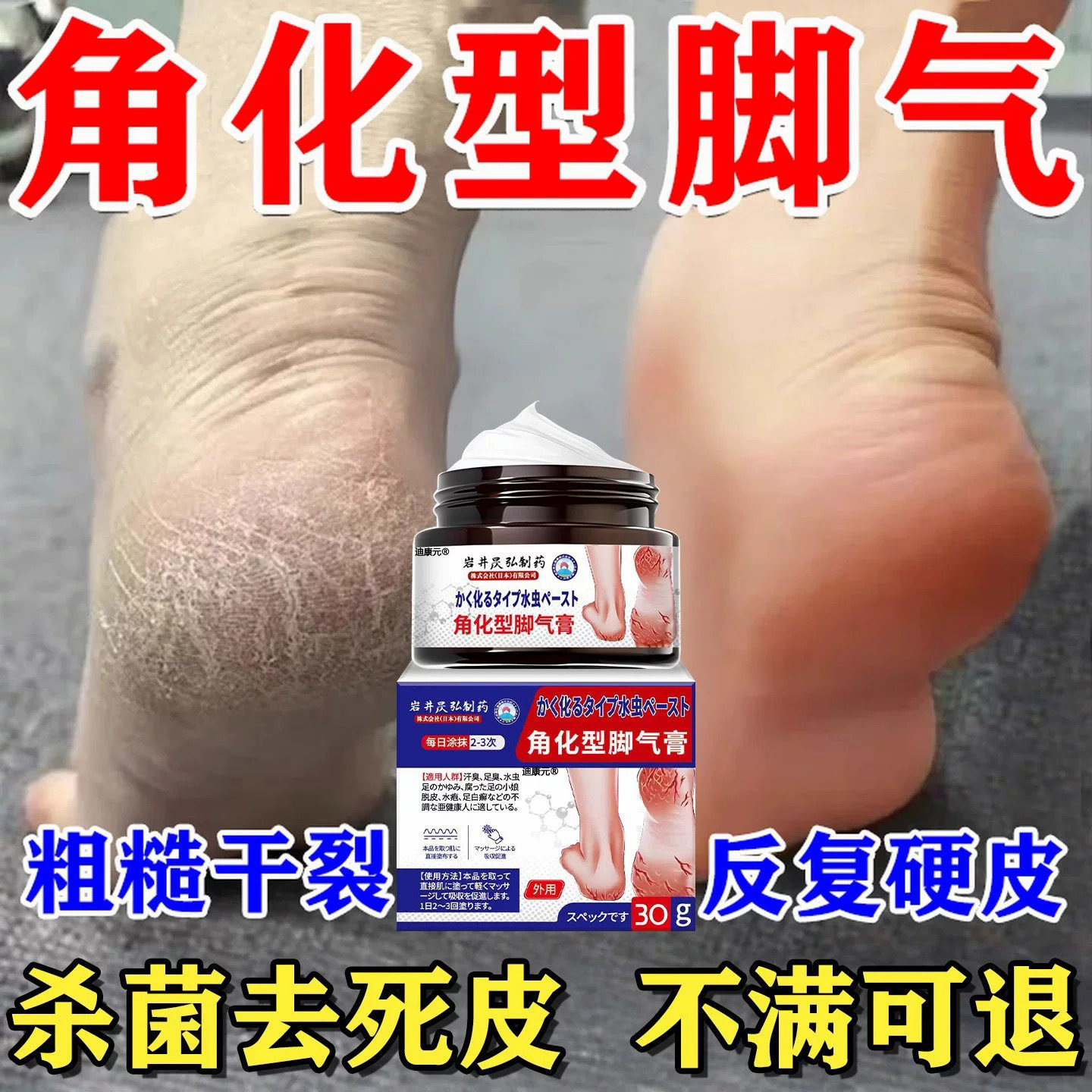 去角化型脚气脚后跟干裂开裂裂口脱皮专用杀菌真菌感染止根痒药房