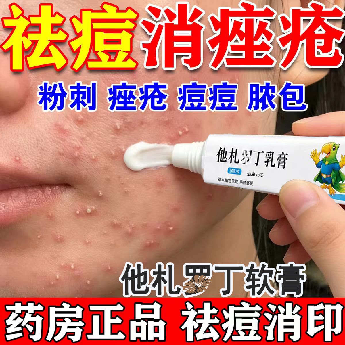 他扎罗乳丁膏红痘印痤疮消脸炎