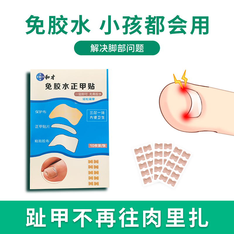 和才免胶水正甲贴甲沟嵌甲矫正贴片器脚趾甲长肉里指甲扎拉拉炎纠