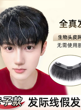发际线贴男假发片假刘海男生刘海真发男士L发际线假发贴日常款男