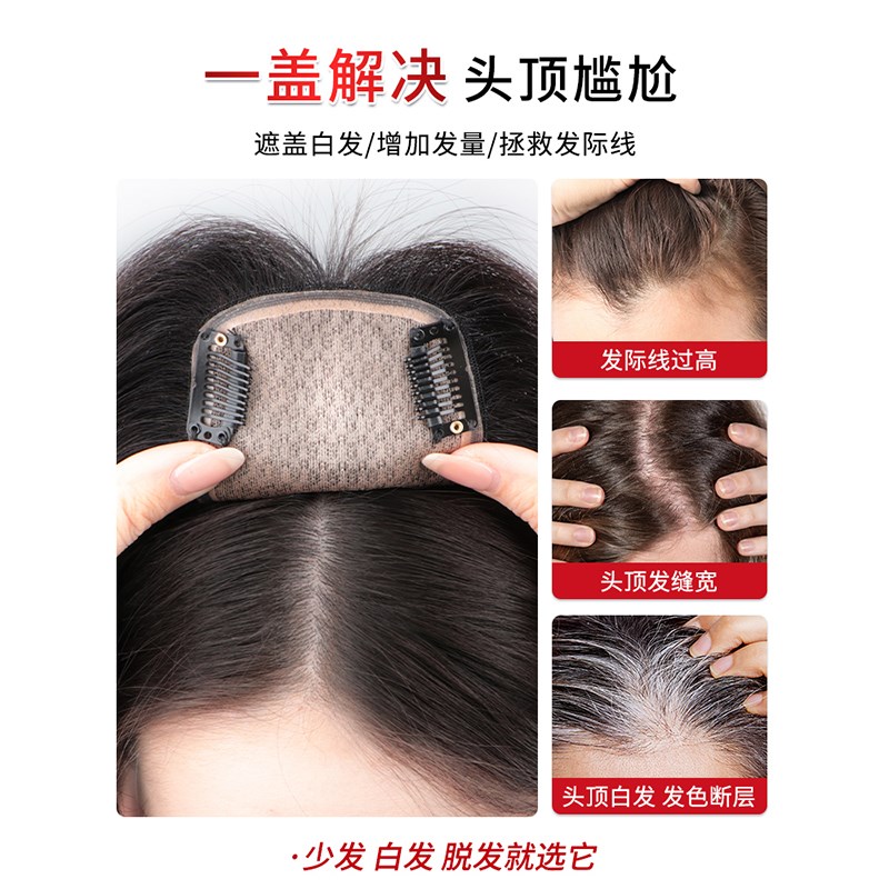 双递针假发片真发女头顶遮白发蓬松增发量高颅顶轻薄无痕补发片