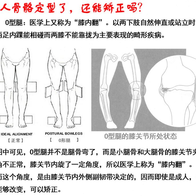 神器内外带字成人X型直弯曲O型腿矫正正腿腿形八带身姿纠儿童绑腿