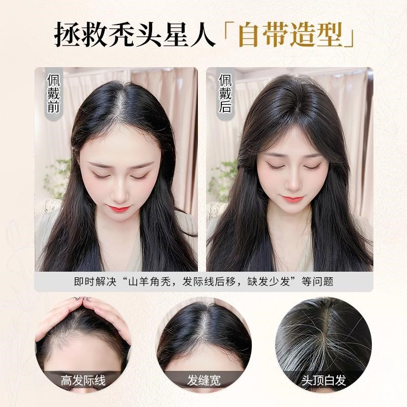 八字刘海假发女片头顶仿全真发补发增发量高颅顶无痕遮白发补发片