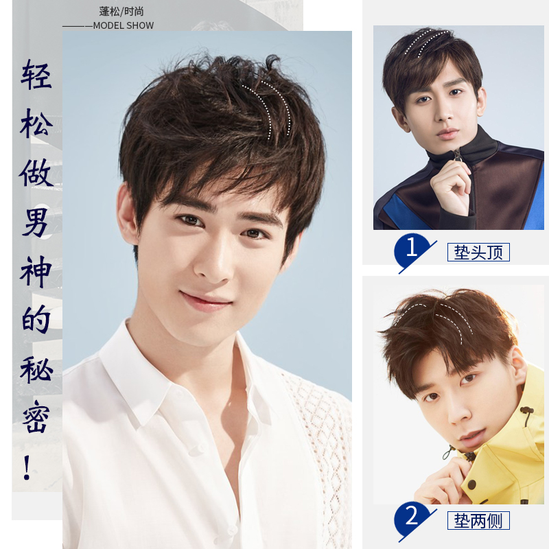 男士补发片垫发片头顶蓬松垫高假发片真发隐形前额补发增发量