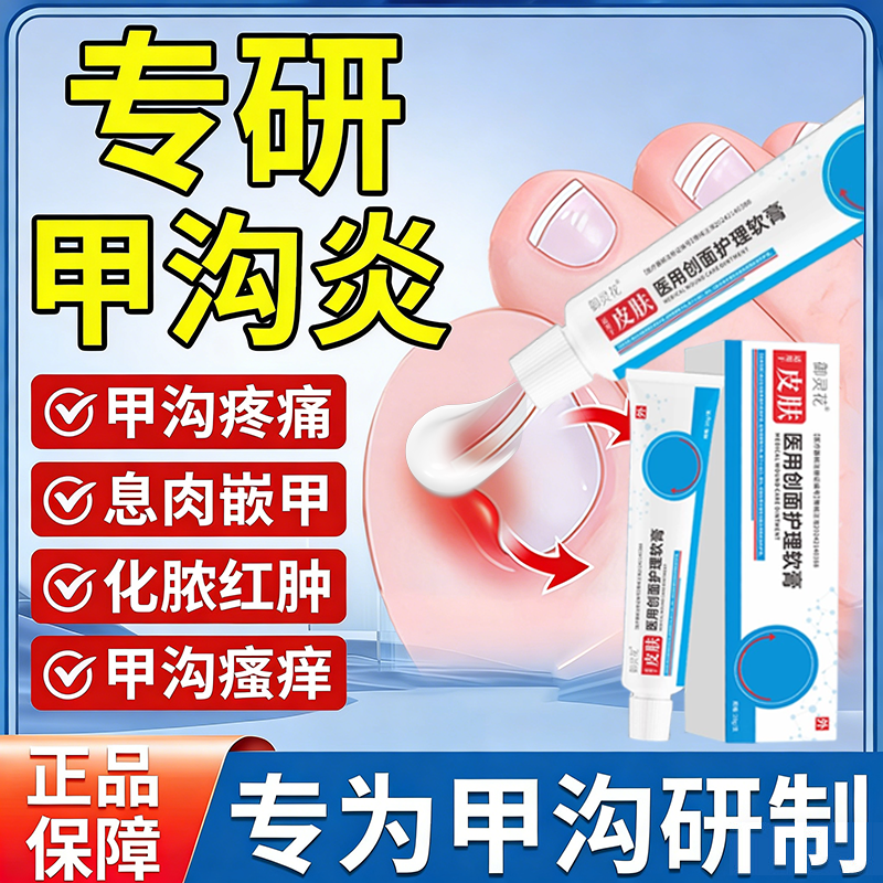 御灵花医用创面护理软膏敷料膏甲沟炎瘙痒疼痛化脓红肿抑菌止痒膏,医疗器械,医用乳膏（器械）,淘宝优惠券,粉丝福利购,淘宝优惠卷