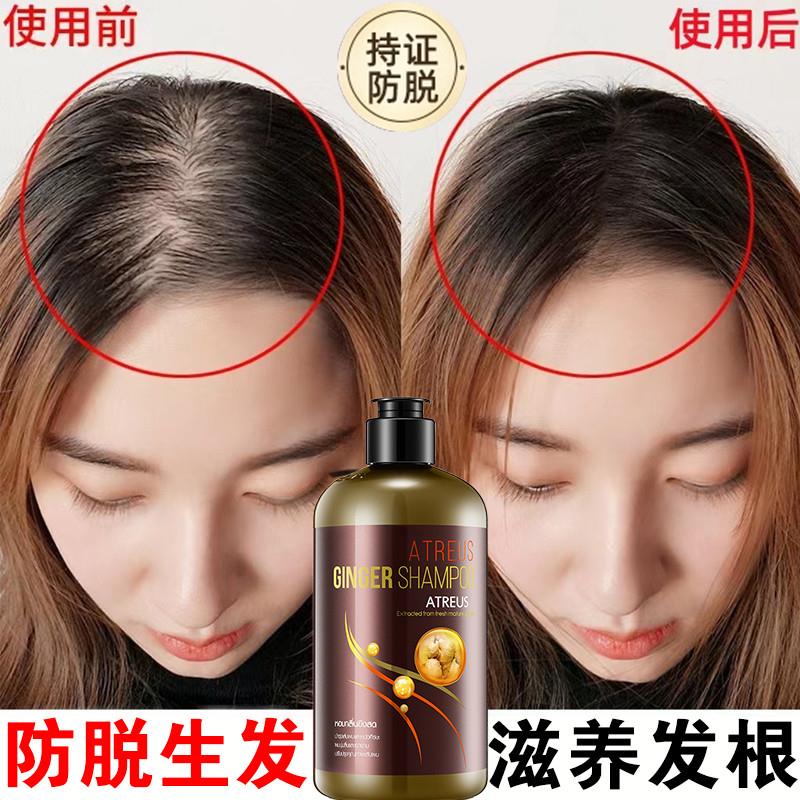 生姜洗发水防脱生发控油蓬松细软塌生发中药增发密发排行榜第一名