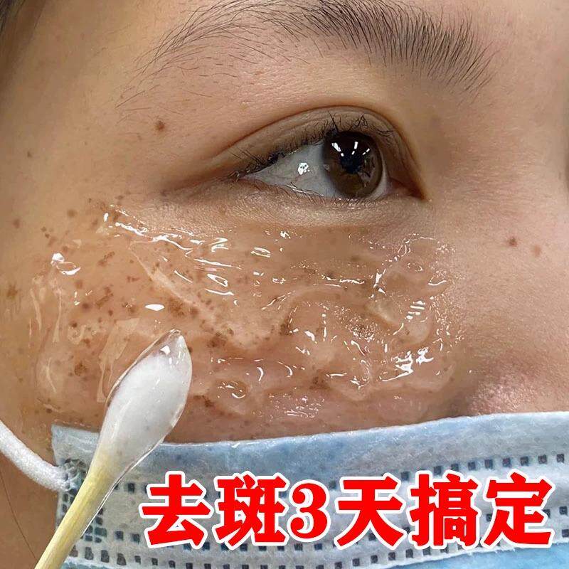 【李佳琪推荐】祛脸上黑点斑点 斑迹 脸上干干净净 跟斑点说拜拜~