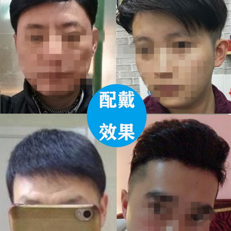 米尔补发男短发假发男士中年头顶补发真人发丝织补发块秃顶补发片