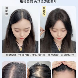 许昌假发片真发真人发丝遮白发蓬松增发量自然隐形递针头顶补发片