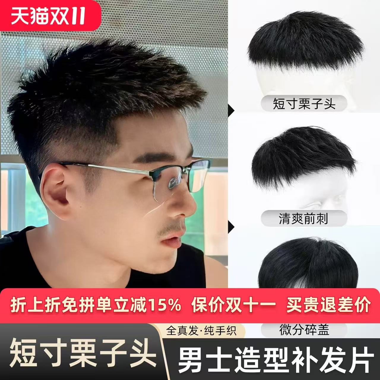 发际线假发帖男士头顶前额自然