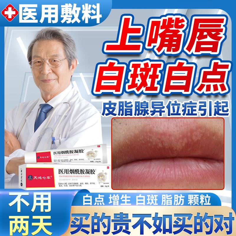 皮脂腺异位症嘴唇白点斑肪