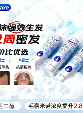 3瓶】xcare进口5%米诺地尔二代泡沫剂男士用防脱生发脱发增发液酊