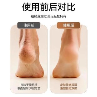去死皮老茧修脚神器家用修足机自动刮脚打磨器 电动磨脚器2025新款