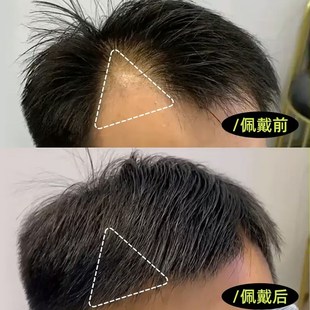 男士假刘海片鬓角补发假发片男女全真人H发m型前额发际线假发贴片