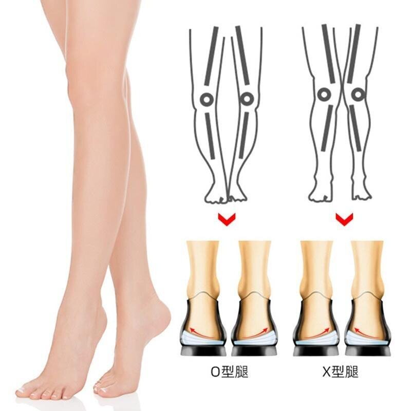 O型腿矫正鞋垫 成人膝内翻足弓垫 舒适按摩鞋垫 修正腿型罗圈腿