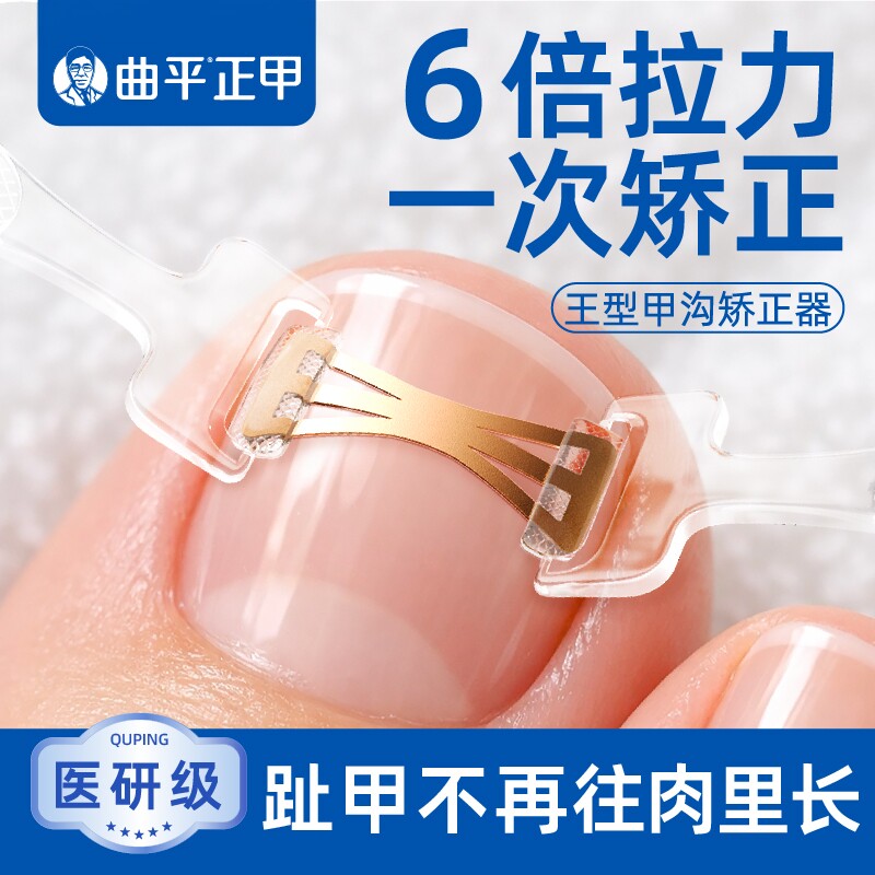 曲平正甲 甲沟嵌甲矫正器贴片医生脚趾甲神器指甲弹丝炎