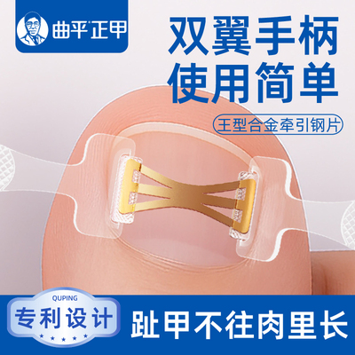 曲平医生王型专利合金牵引贴