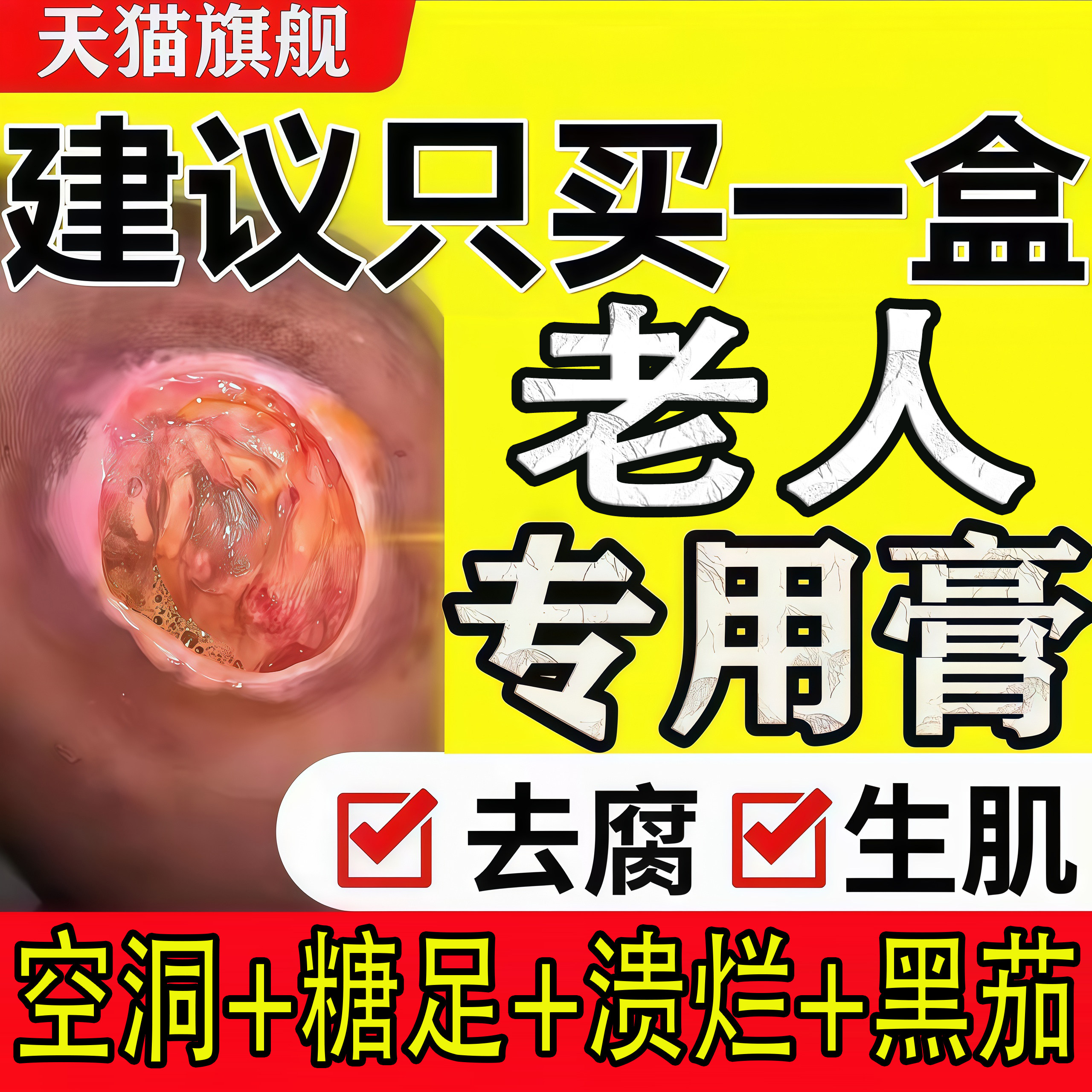 褥创膏老人臀部皮肤溃烂