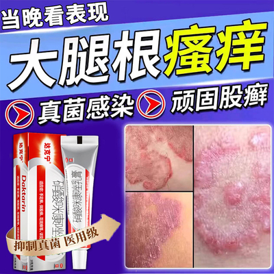 [达克宁]硝酸咪康唑乳膏2%*20g*1支/盒