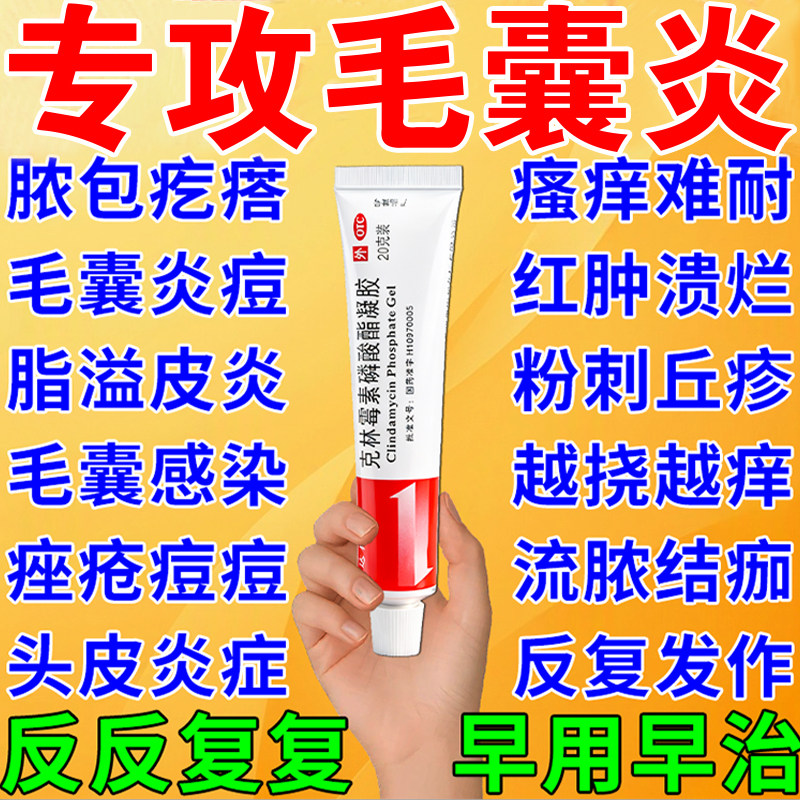 克林霉素磷酸酯凝胶祛痘头部上脂溢性皮炎痒毛囊炎特药效头部专用