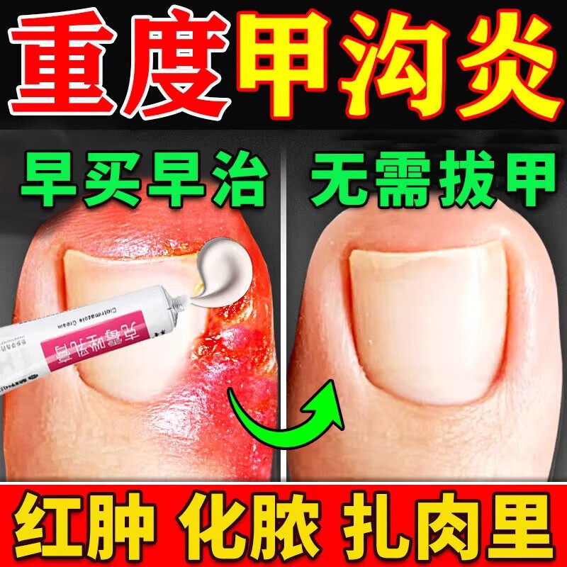 【辰欣】克霉唑乳膏3%*10g*1支/盒