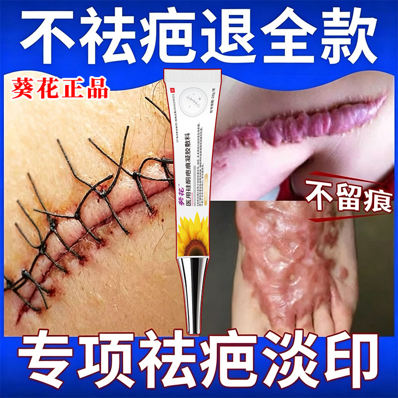 祛疤痕除疤第一名医用硅酮凝胶
