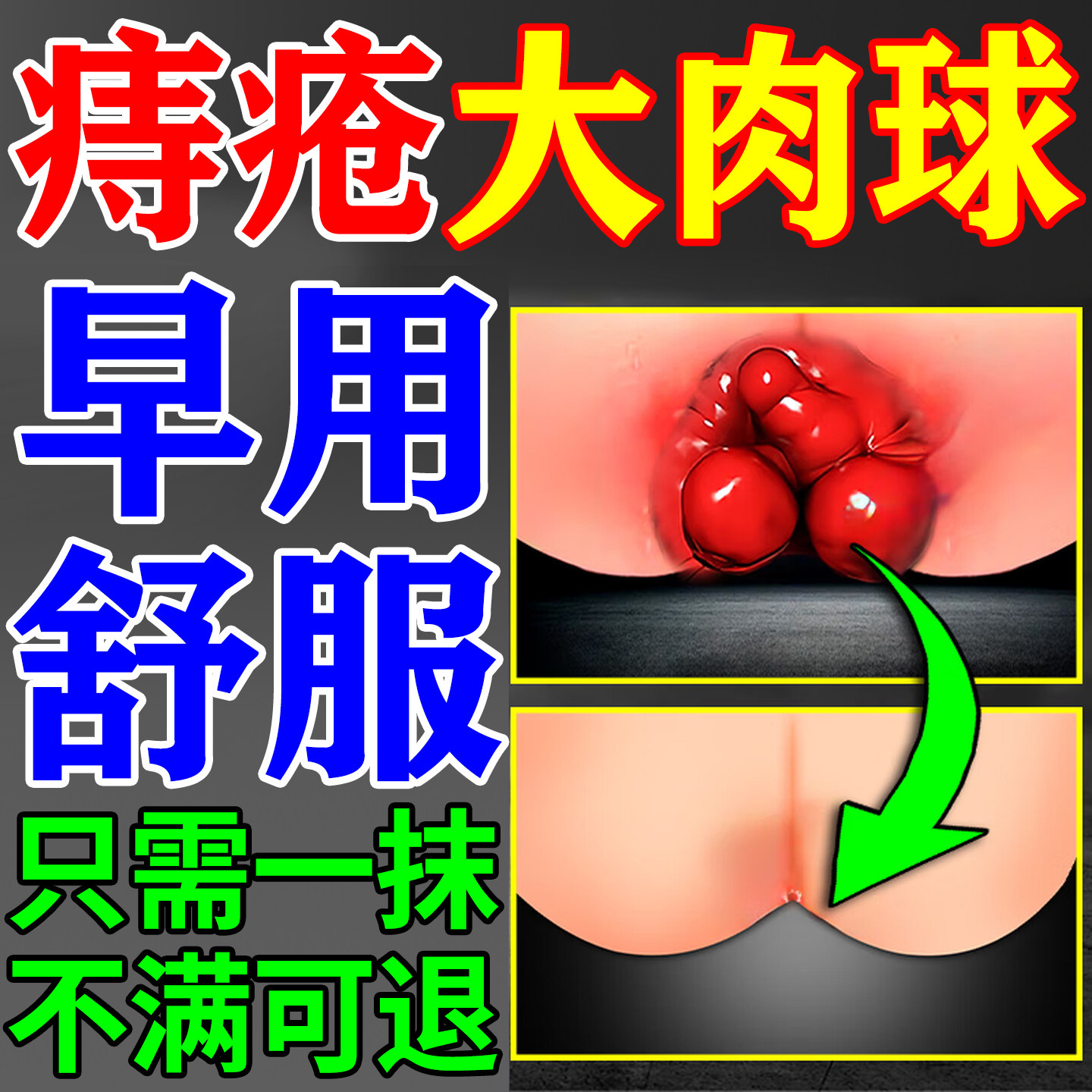 活络瑾乐小白管痔疮膏肖肉球痔根非断正品痔凝胶男女性官方旗舰店