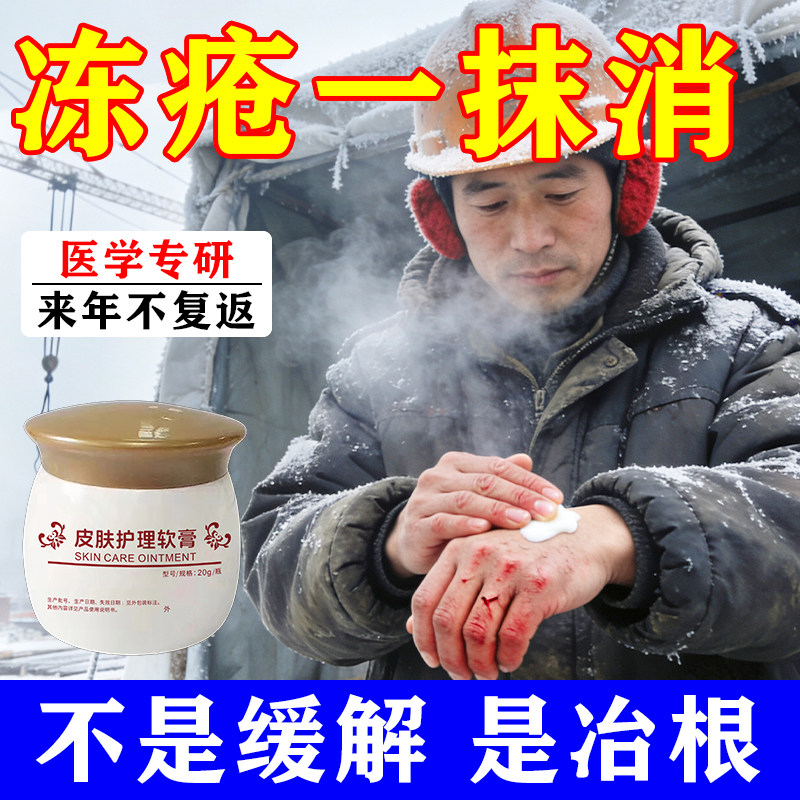 鼎芙冻疮膏冻伤膏止痒冻特疮效消酊防冻裂霜正品耳朵脸部消肿药