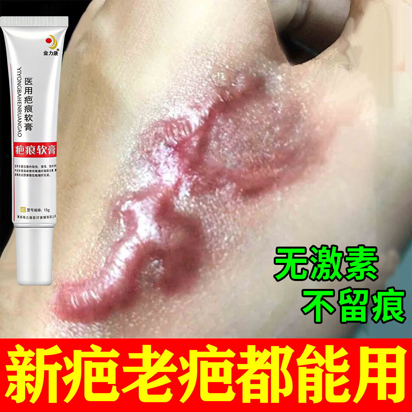 时青中笑巴巴清旗舰店印立清医用疤痕儿童磕伤手术伤疤剖腹产官方