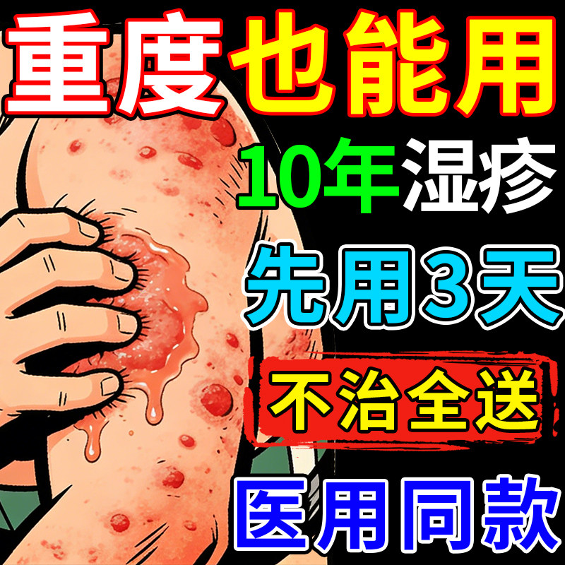 重楼解毒酊湿疹药膏止去外用顽固痒根皮炎膏专皮肤瘙特止疹痒效