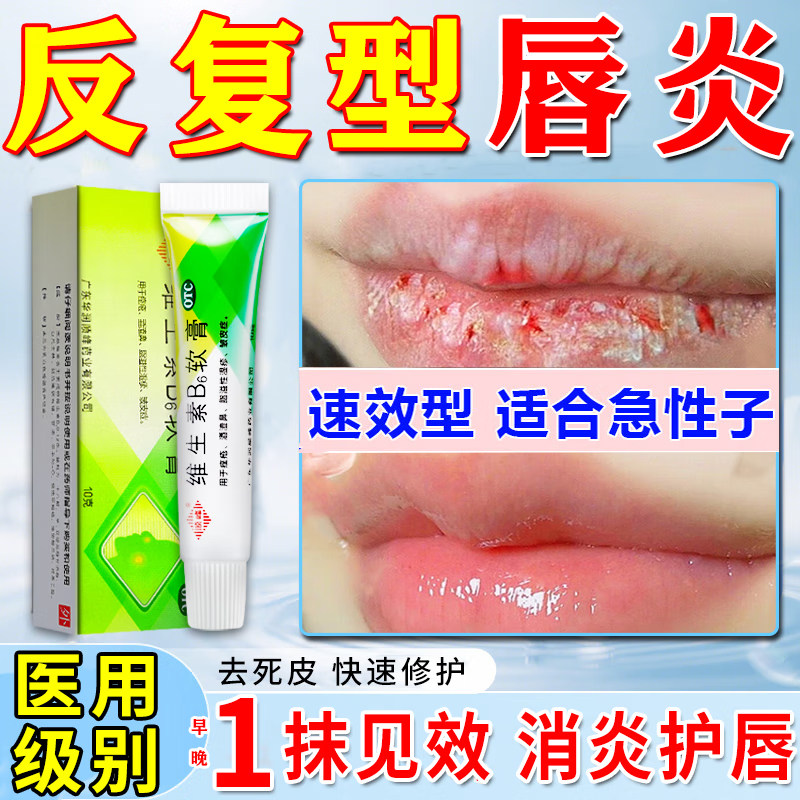 维生素b6软膏唇炎专用药膏唇炎唇膏嘴唇干裂脱皮医用型儿童成人