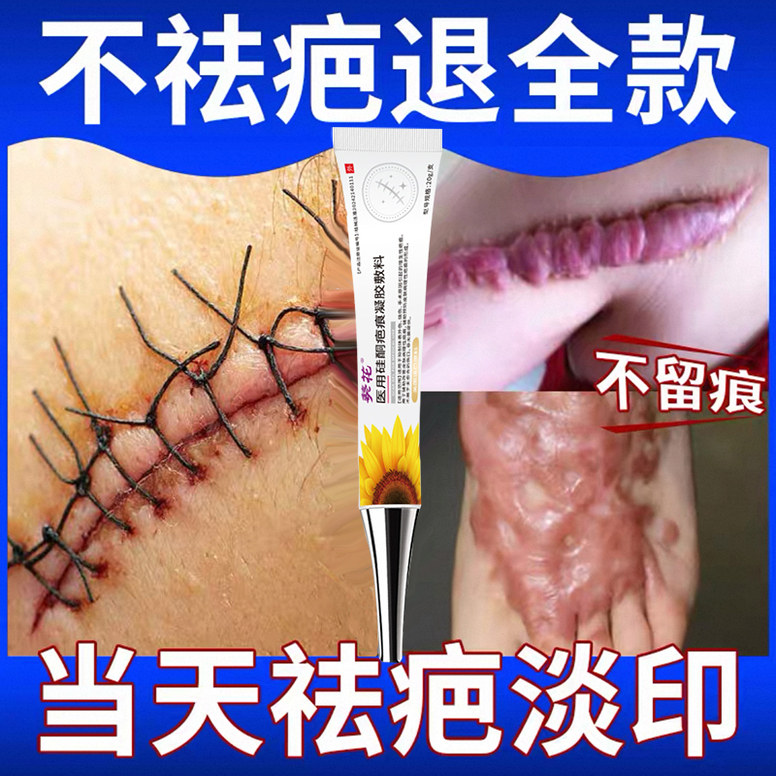 美皮护美皮护疤痕贴官方旗舰店